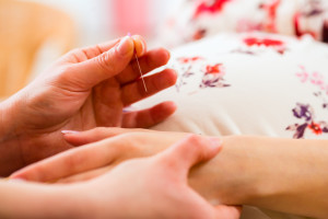 Hebamme gibt Schwangeren Akupunktur